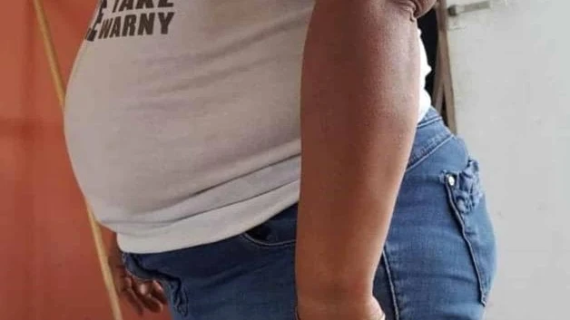 Avanza la obesidad en Reynosa