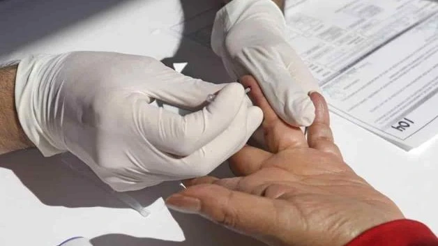 El costo de luchar contra el VIH/SIDA