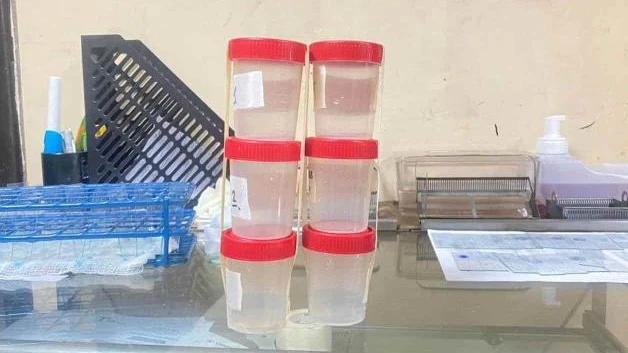 Alerta por casos de tuberculosis en Reynosa