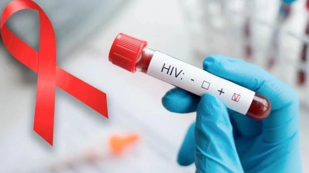 Aumentan casos positivos de VIH en Tamaulipas