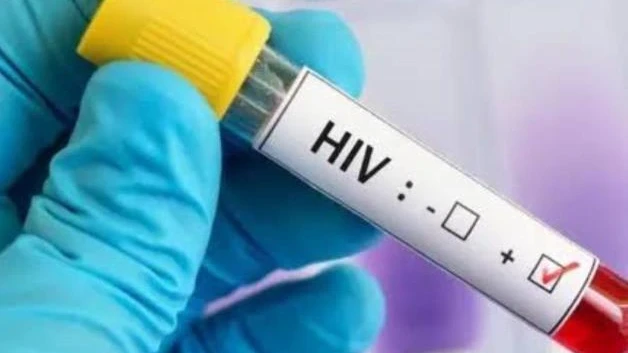 Rechazan el tratamiento infectados con VIH-SIDA