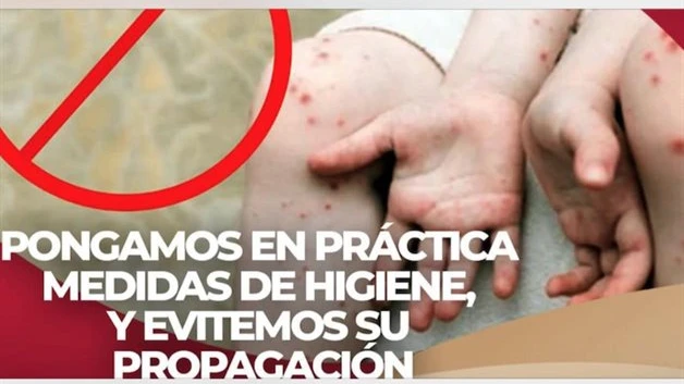 Descarta Salud estatal la alerta epidemiológica