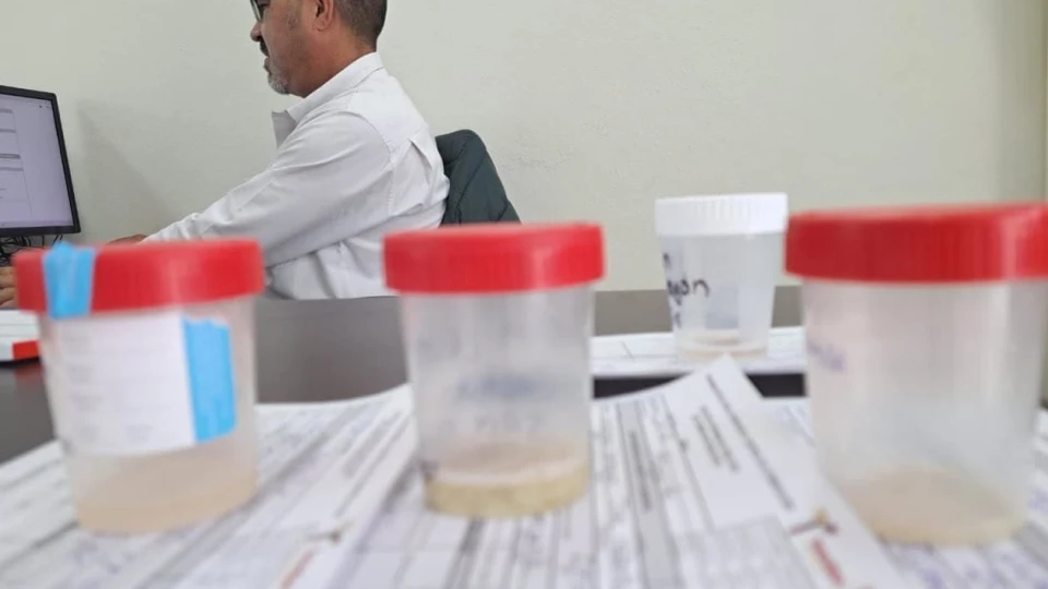 Alarma por tuberculosis: Van 139 casos