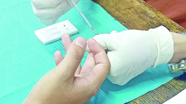 Detectan en 10 minutos el VIH en la Cruz Roja