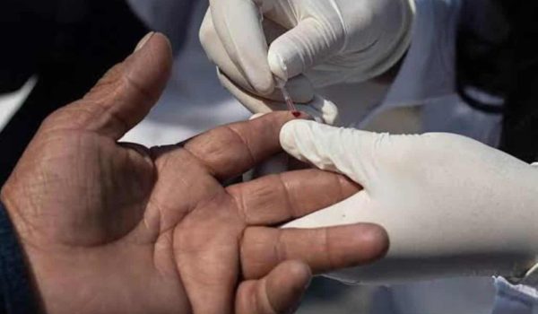 Suma Tamaulipas 42 casos de VIH